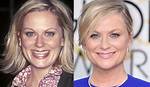 Amy Poehler Plastic Surgery Before and After Botox Injections |