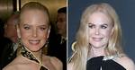 Behind the Lens: Nicole Kidman Botox Photos and the Pursuit of Timeless Beauty