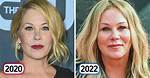 Christina Applegate Faces off with a Troll Who Says Her Face Was Ruined by Plastic Surgery, Not Ms