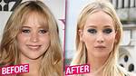 Did Jennifer Lawrence Have Plastic Surgery? |