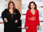 Did Kathy Najimy Undergo Weight Loss Surgery? Here's What We Know About the Actress