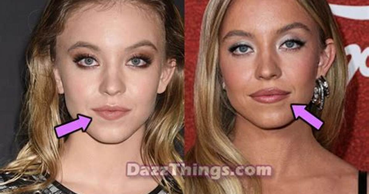 Did Sydney Sweeney Get Plastic Surgery Cassie