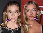 Did Sydney Sweeney Get Plastic Surgery Cassie