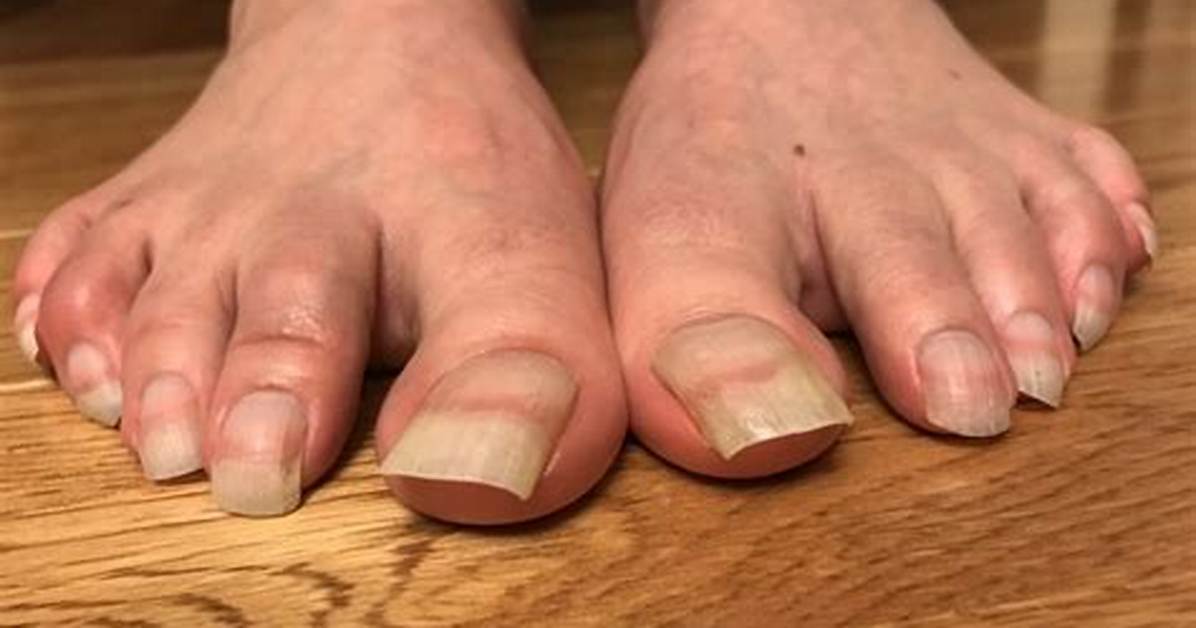 Discover the Secrets of Big Natural Toes: Unlocking Health and Beauty
