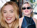 Florence Pugh Lip Filler: the Transformation of a Rising Star