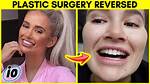 Haley Layne Plastic Surgery Before: Unveiling the Truth