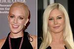 Heidi Montag Before and After Surgery: Navigating the Reality Tv Stars Transformation