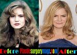 Jennifer Jason Leigh's Plastic Surgery Journey