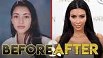 Kim K's Transformation: Before and After Bbl