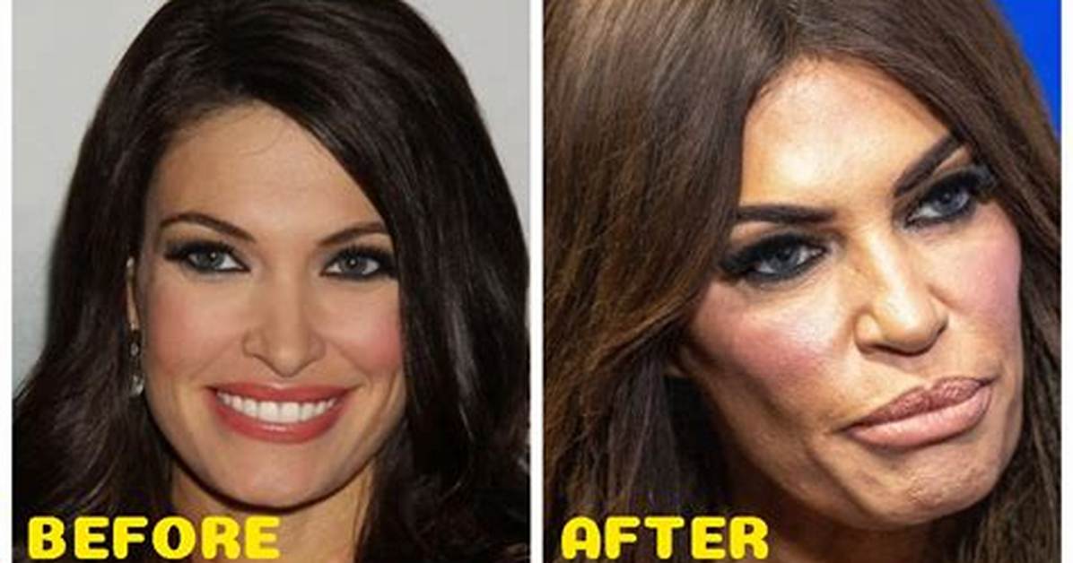 Kimberly Guilfoyle: Beauty, Politics, and the Plastic Surgery Rumors