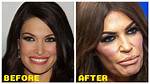 Kimberly Guilfoyle: Beauty, Politics, and the Plastic Surgery Rumors