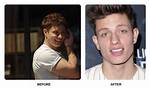 Matt Rife Teeth