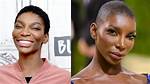 Michaela Coel: the Truth Behind Plastic Surgery Rumors