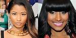 Nicki Minaj's Skin Journey Explored
