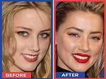 Plastic Surgery Speculations Surrounding Amber Heard and Johnny Depp