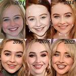 Sabrina Carpenter's Plastic Surgery: Transformation and Procedures