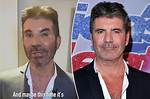 Simon Cowell's Mysterious Illness: What's Behind the Health Concerns?