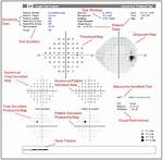 Understanding Bayley Humphrey Disease: a Comprehensive Guide