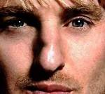Understanding Owen Wilson's Deviated Septum and Unique Nose