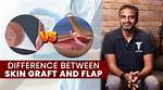 Understanding the Differences: Flank vs Flap