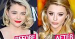 Unveiling Chloe Grace Moretz's Plastic Surgery Secrets: a Comprehensive Exploration