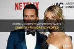 Unveiling Rob Mcelhenney's Plastic Surgery Journey: Before and After Transformation