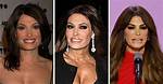 Unveiling the Transformation: Kimberly Guilfoyle's Journey Through Plastic Surgery