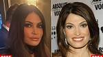Unveiling the Truth Behind Kimberly Guilfoyle Fillers