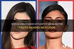 Unveiling the Truth Behind Kylie Jenner's Botox Migration: Discoveries and Insights