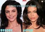 Vanessa Ferlito Plastic Surgery Before and After