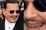 What Happened to Johnny Depps Teeth? |