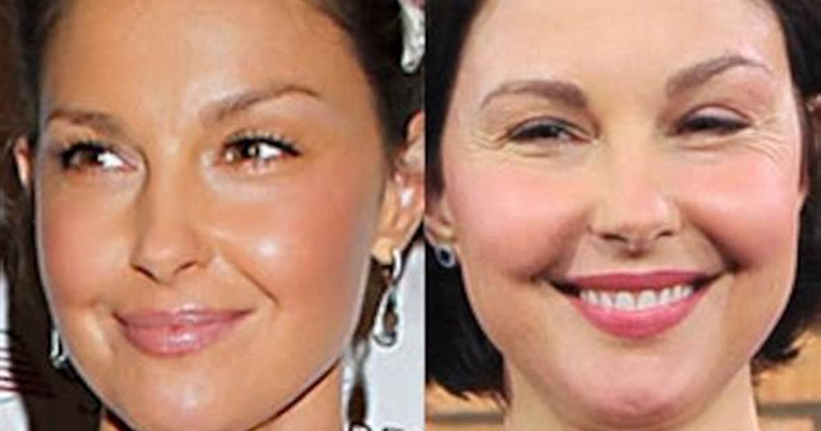 What Is Wrong with Ashley Judd: a Comprehensive Look at Her Health and Challenges