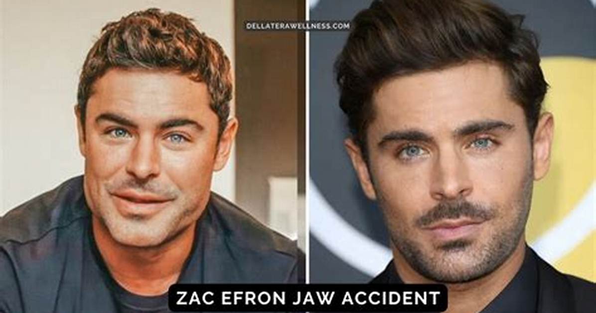 Zac Efron's Jaw Surgery Accident: the Untold Story